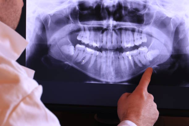 Best Same-Day Emergency Dentist in Corsicana, TX