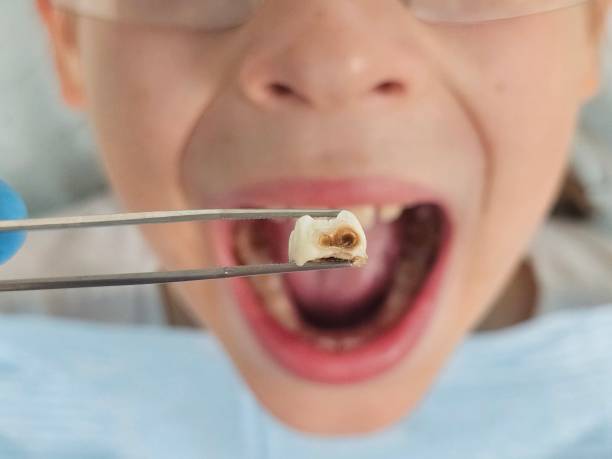 Best Emergency Orthodontic Repairs in Corsicana, TX