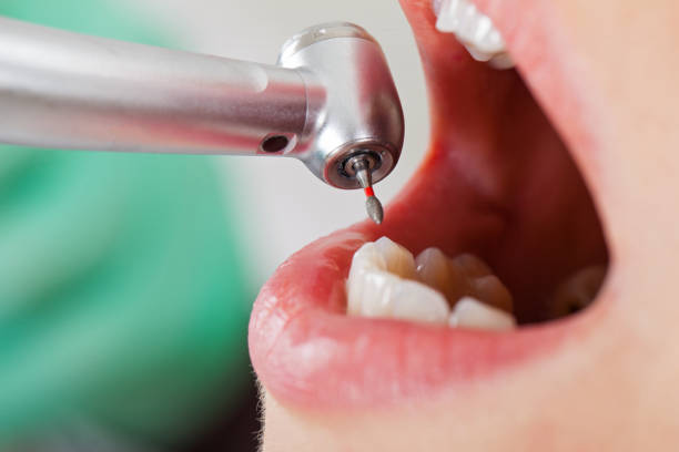 Best Emergency Treatment for Toothache in Corsicana, TX